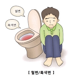 대장암 초기증상