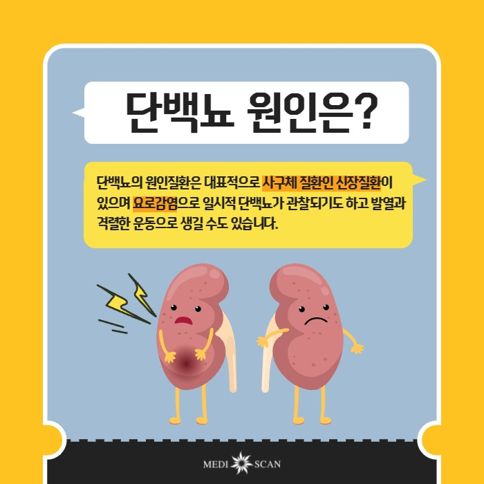 소변에 거품이 나는 이유 증상 해결책