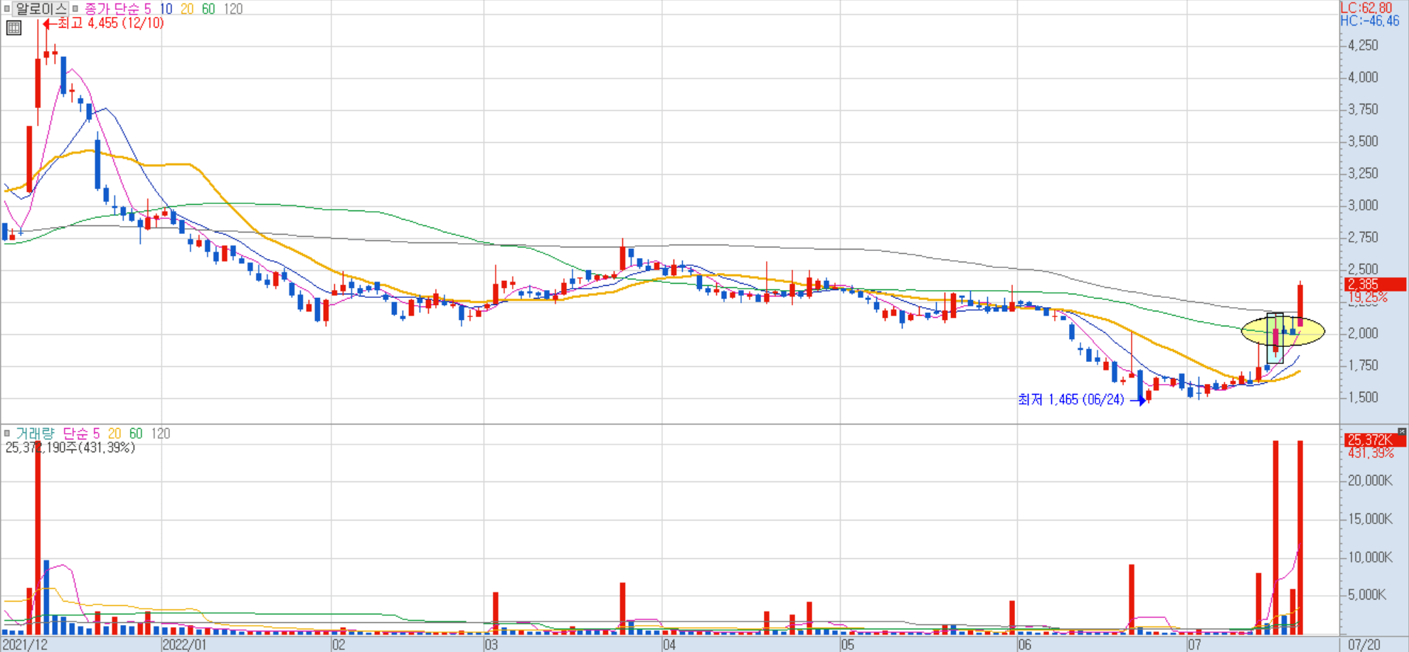 알로이스 일봉 차트