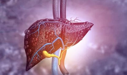 간암(Liver Cancer)