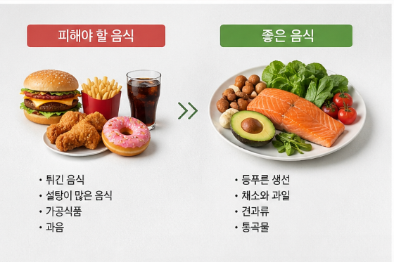 고중성지방혈증 치료와 예방