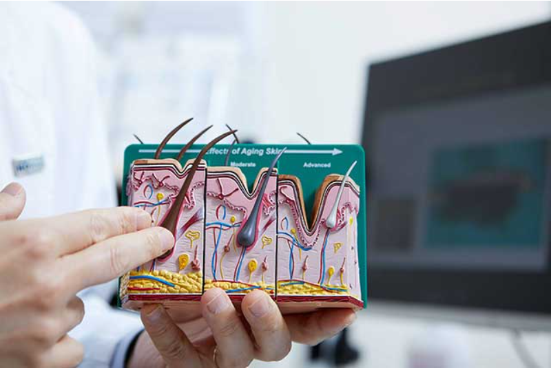 모낭-모형을-가리키며-탈모를-설명하는-사진