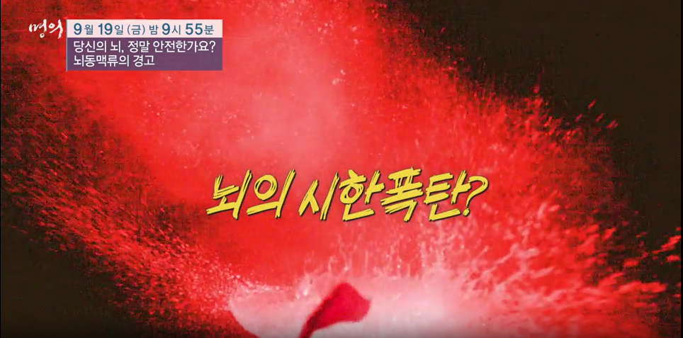 명의/ 당신의 뇌&amp;#44; 정말 안전한가요? - 뇌동맥류의 경고