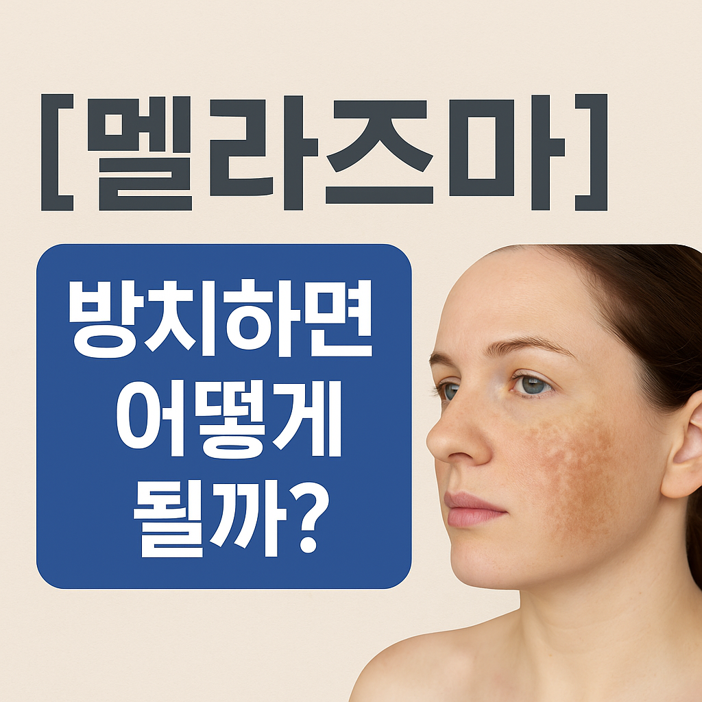 [멜라즈마] 방치하면 기미보다 치료비 3배 듭니다