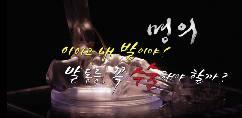 명의 발통증 족저근막염