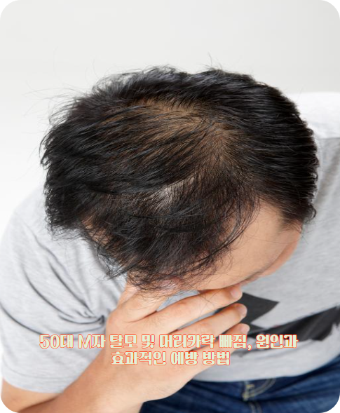 50대 M자 탈모 및 머리카락 빠짐, 원인과 효과적인 예방 방법