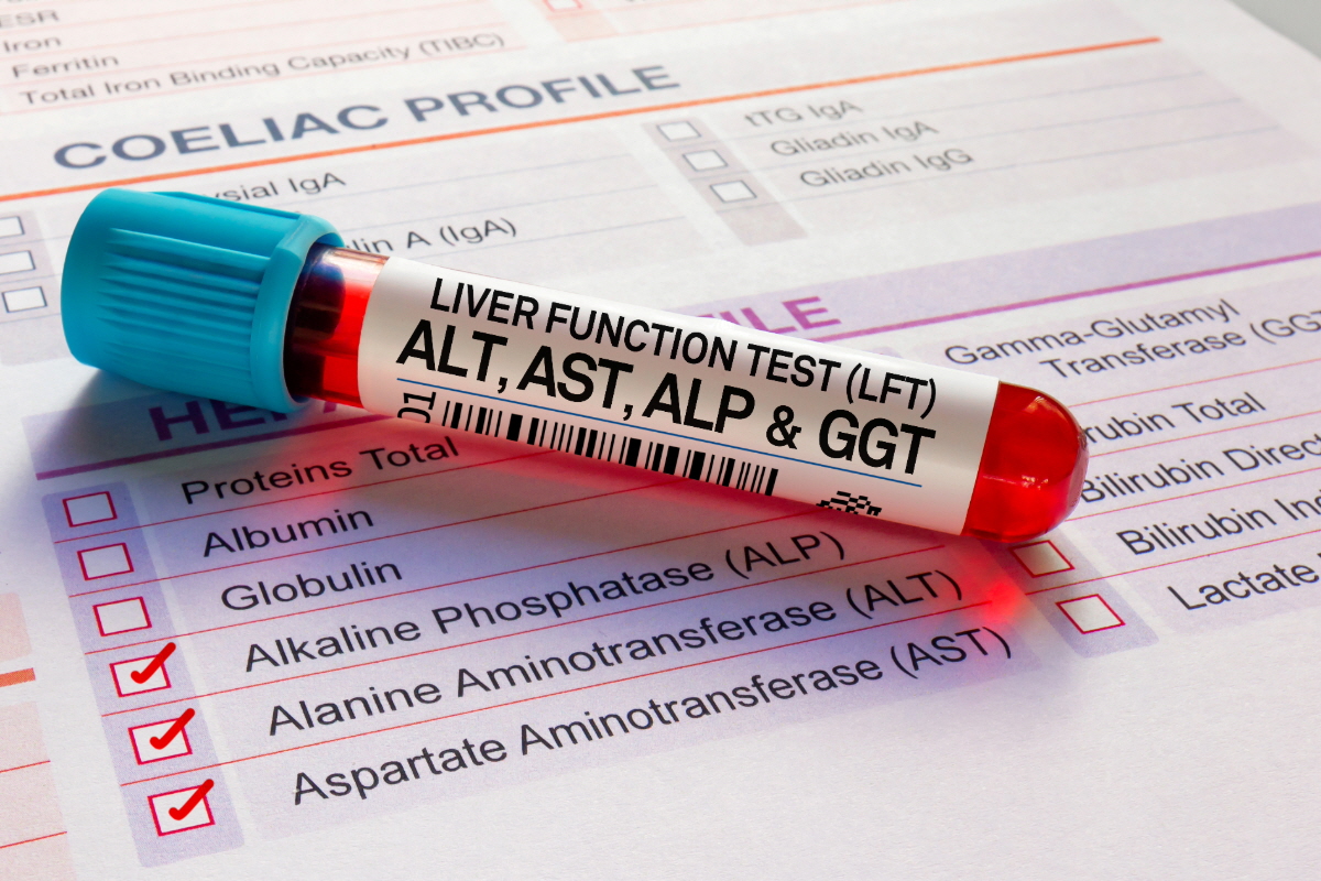 간 수치 낮추는 방법
