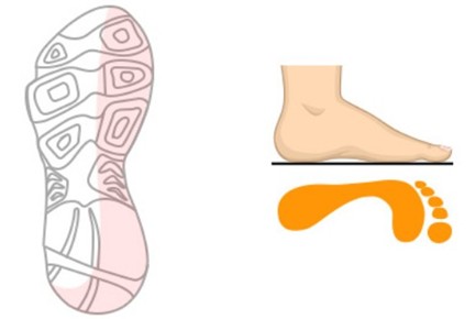 로우아치 런닝화 고르는법