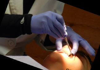 이모튼 캡슐 효능 부작용 가격