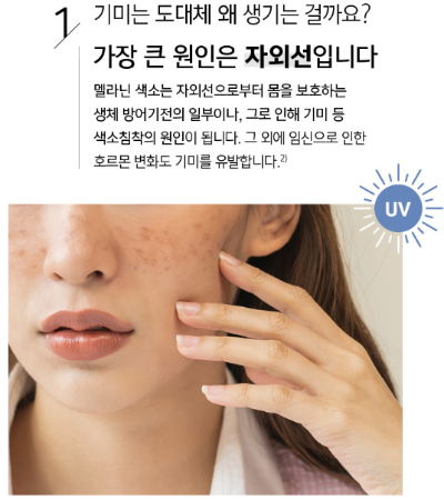 기미의 주요 원인