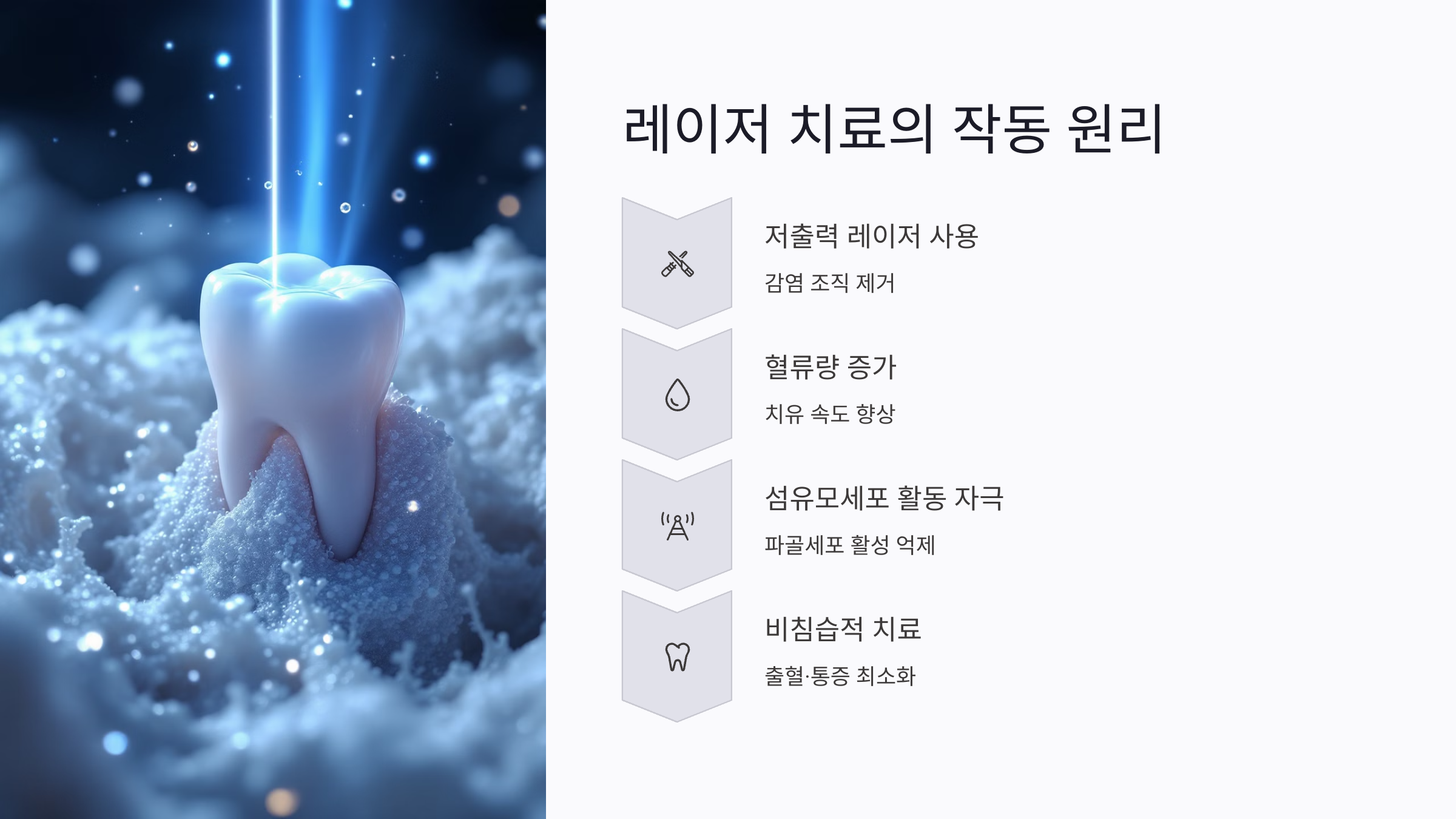 잇몸뼈 레이저 치료는 어떤 방식으로 작동하나?