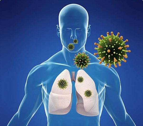 결핵 검사 비용