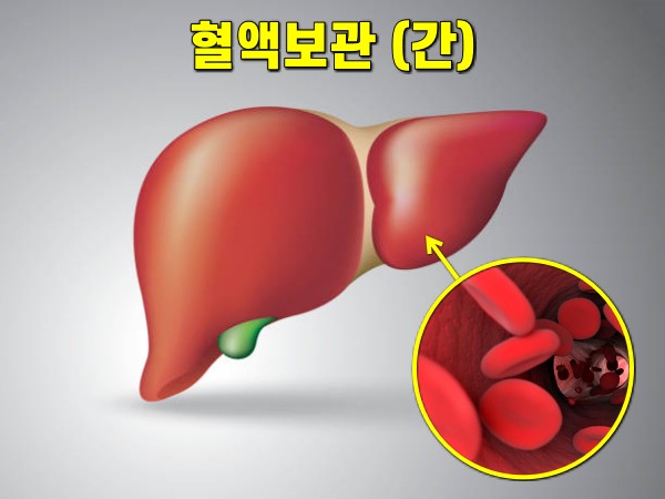 혈압이 높아지는 이유, 혈압 높은 이유, 혈압 낮추는법