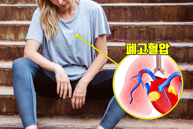 혈압이 높을때 증상, 고혈압 증상, 숨이 차는 증상,가슴통증