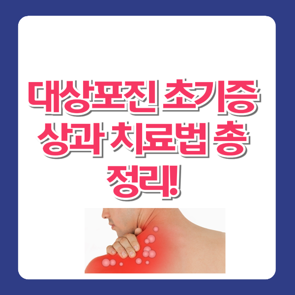 대상포진 초기증상과 치료법 총정리!