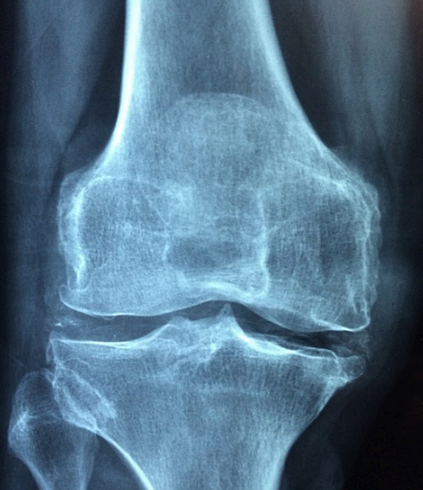 콘드로이친 1200mg