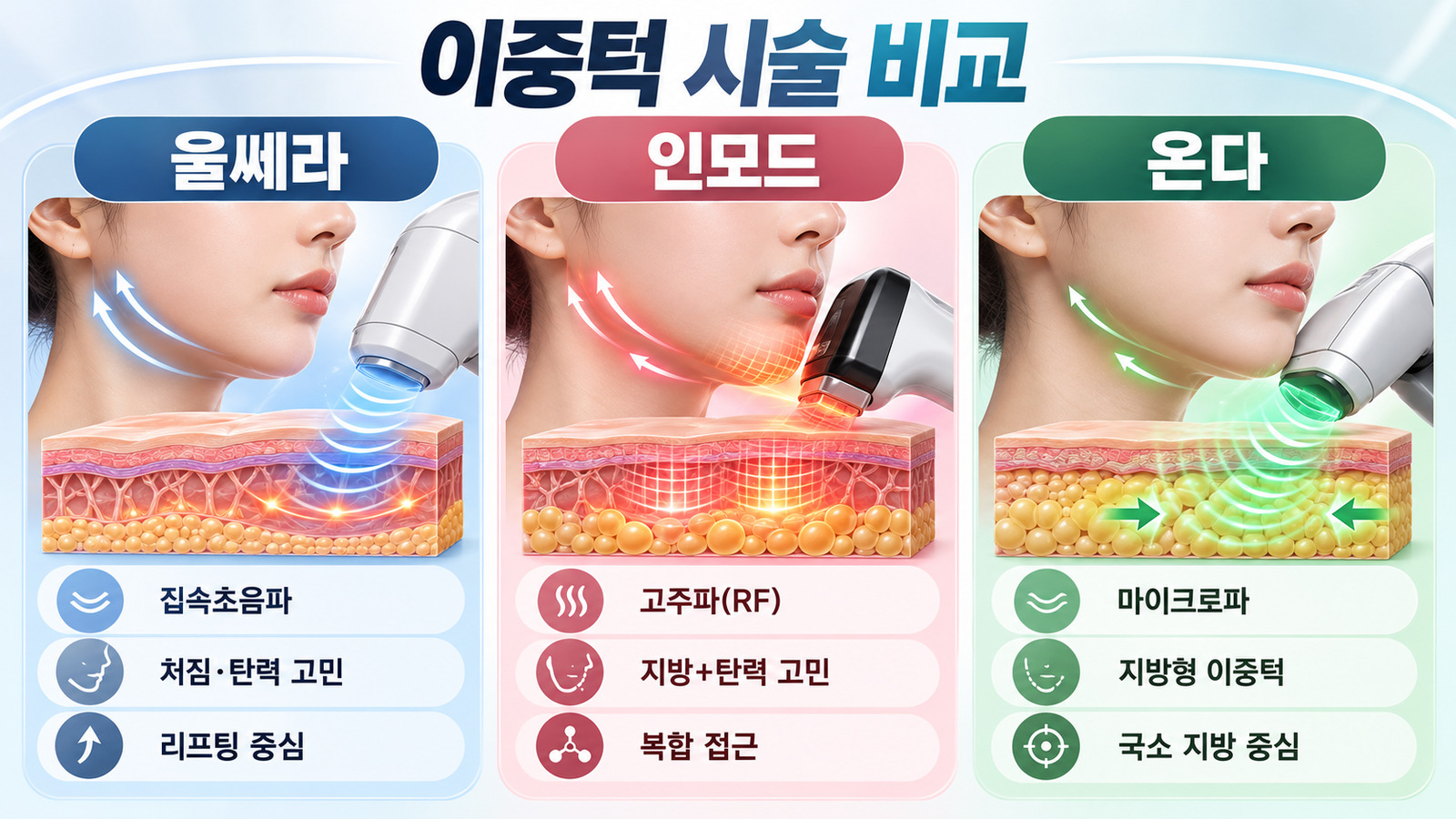 울쎄라의 집속초음파, 인모드의 고주파, 온다의 마이크로파를 턱선과 피부층 그림으로 나란히 비교한 인포그래픽
