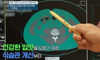 식습관개선