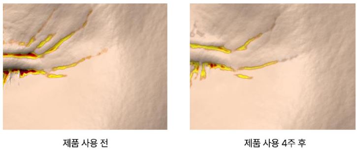 카르노신-세럼-효과