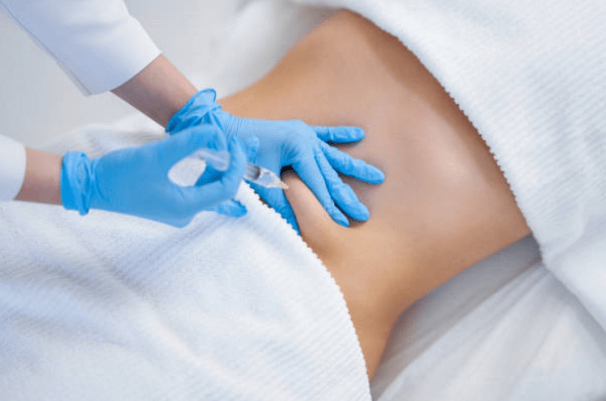 지방 분해 주사