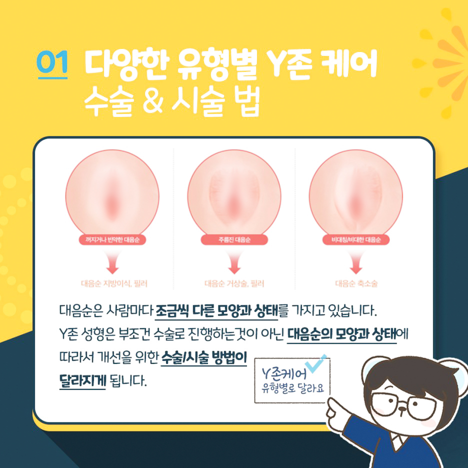다양한 유형별 y존케어 수술 시술법