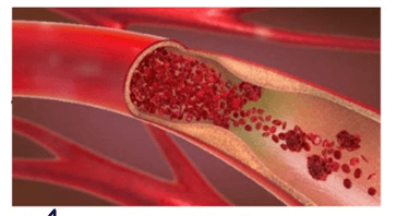 중장년 건강기능식품 추천 TOP 5