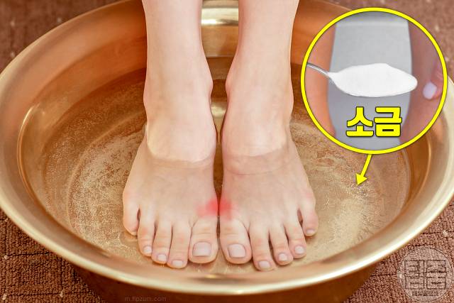 엄지발가락 옆 통증 건막류 치료 엄지발가락 휘어짐 족욕