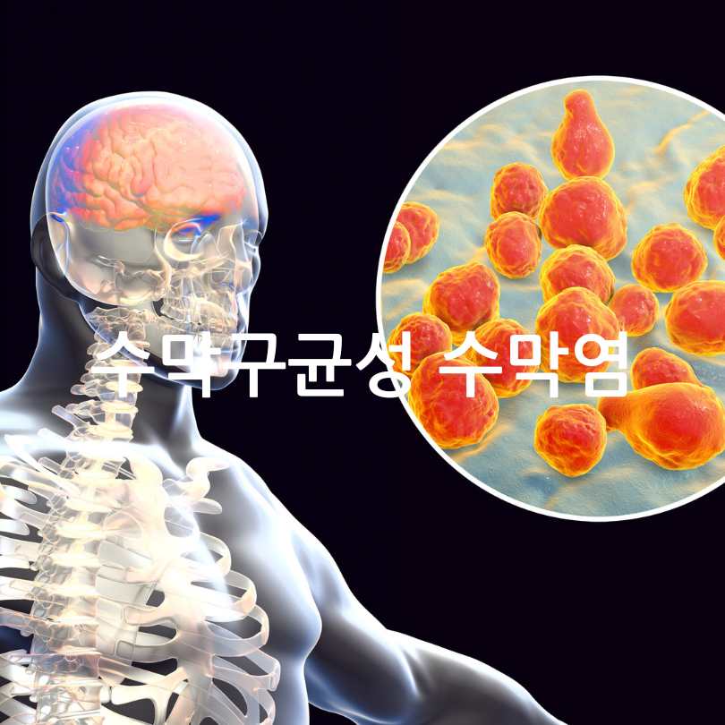 수막구균성 수막염 증상, 원인, 대처법