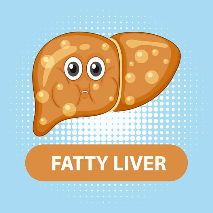 지방간 예방과 개선 식단