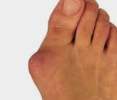 발바닥 통증부위