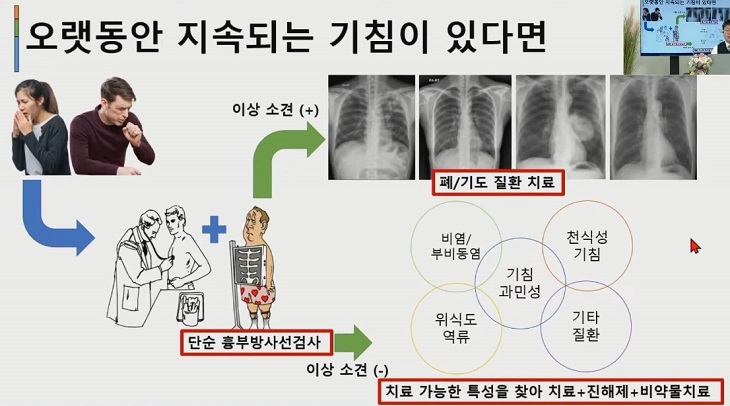 여창동교수-만성기침