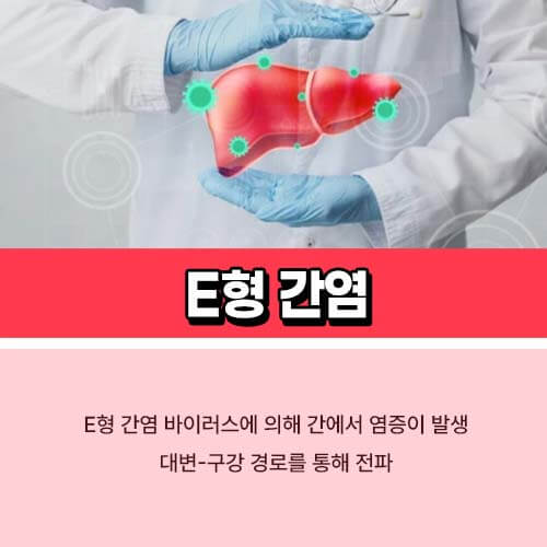E형_간염