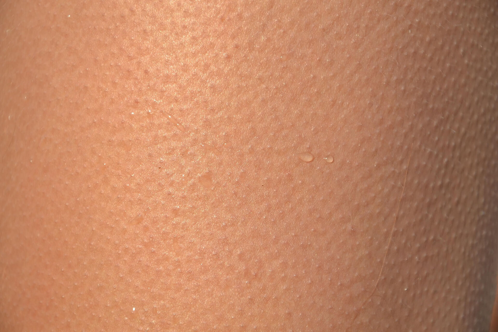 황사 피부 트러블 심해지는 이유? 피부과가 알려주는 관리 방법