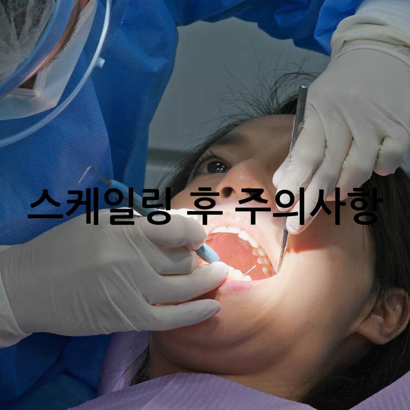 치아 스케일링의 효과와 중요성