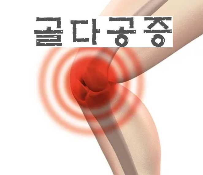 골다공증