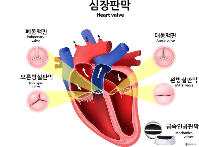 심장판막증 증상
