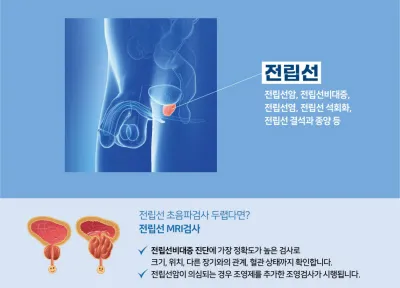 전립선암 초기증상
