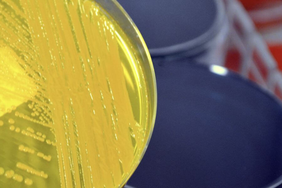 위생을 대하는 태도가 바뀐 결정적 순간, 세균막(바이오필름)을 알게 되다