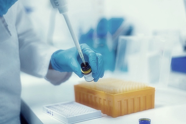 셀트리온 주가분석