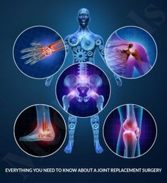 맥문동 효능 5가지 먹는방법 맥문동 차 분말 먹는법 부작용