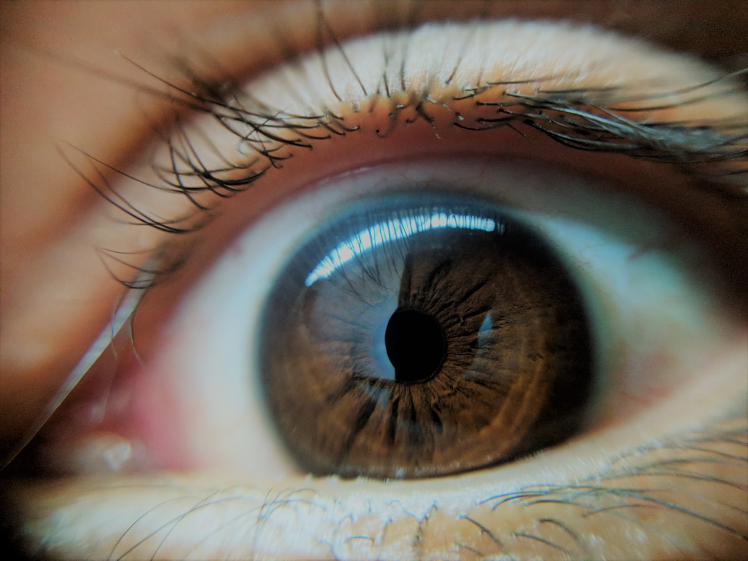 Glaucoma