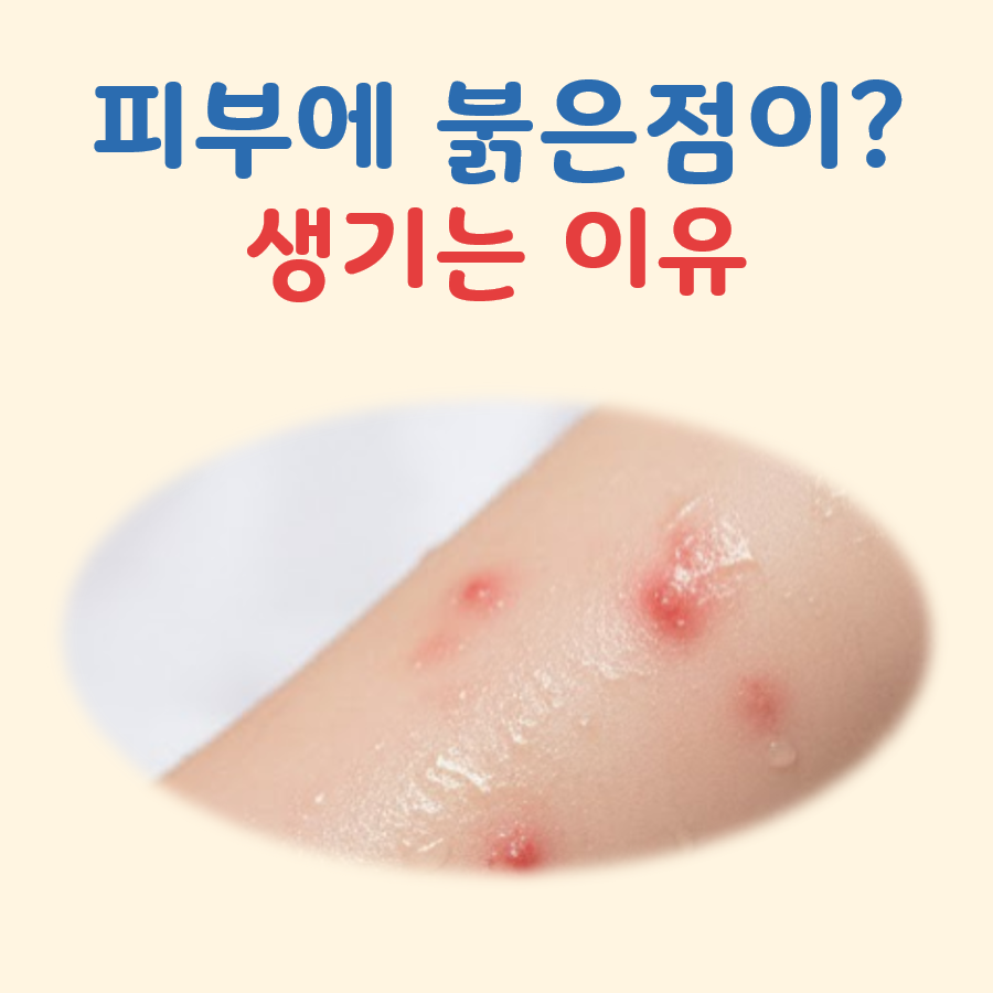 피부에 붉은점이 생기는 이유 대표 이미지