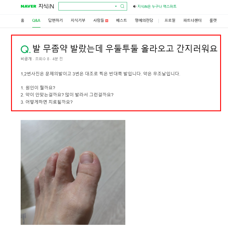 무좀약 바른 후 트러블 질문