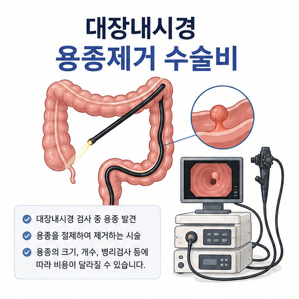 대장 모형과 내시경을 이용해 대장내시경 검사 중 용종을 제거하는 수술비 정보를 안내한 이미지