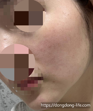 중계의원 기미 리뷰