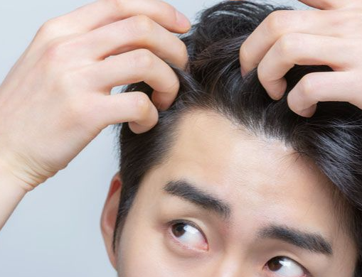 젊은 나이에 새치