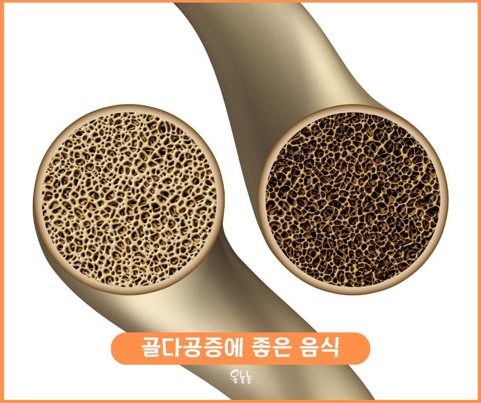 골다공증에 좋은 음식