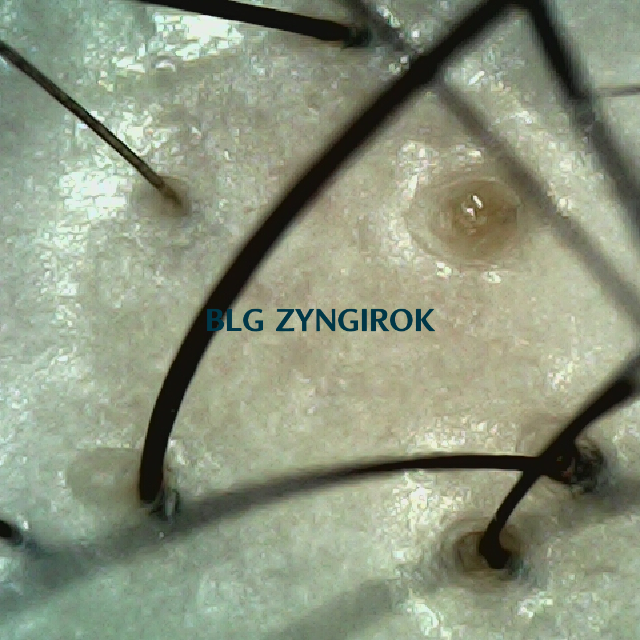 피나모아 복용 11주차 두피사진 - 정수리와 이마 사이 모습이다.