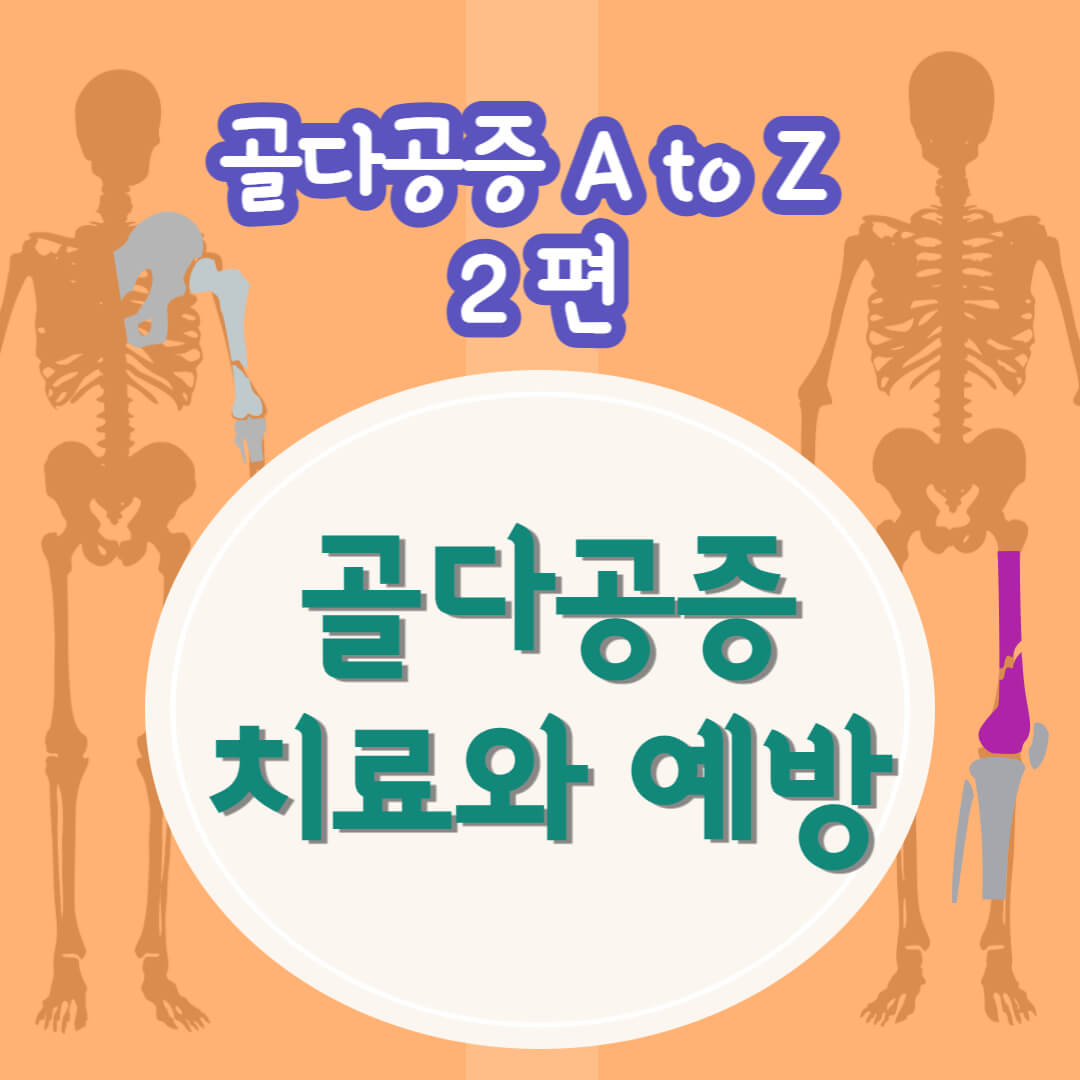 골다공증 치료와 예방