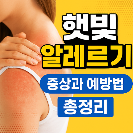 햇빛알레르기 증상과 예방법 총정리, 여름철 피부 트러블 원인 바로 알기 (이미지 챗지피티)